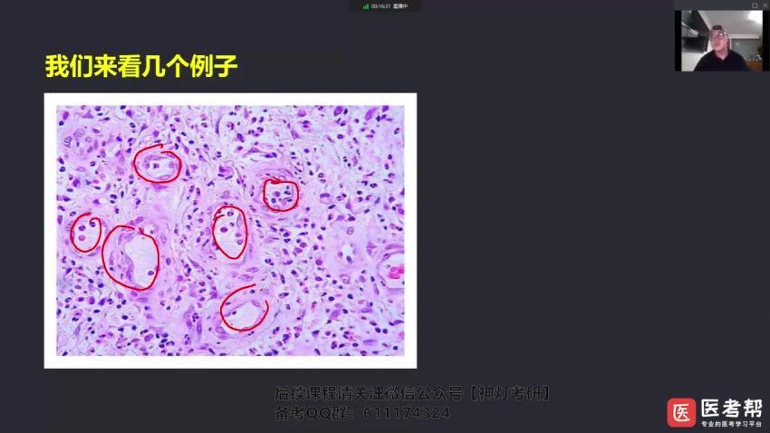 2024考研西综：【医考帮】全年集训营 百度网盘(403.33G)